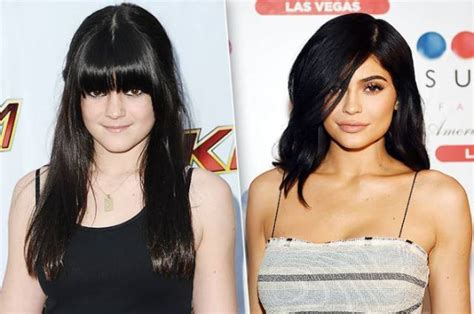 Kuvatulokset haulle celebrities with lips done