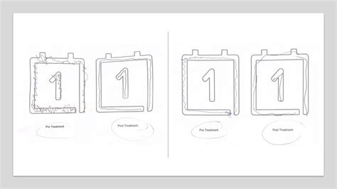 Image result for Insightec Essential Tremor