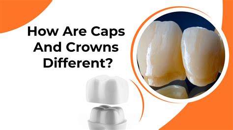 How Are Caps And Crowns Different?