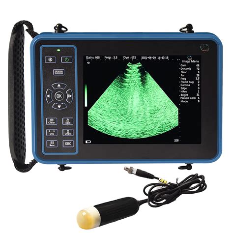Portable Ultrasound Machine