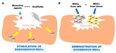 Implementation of Endogenous and Exogenous Mesenchymal Progenitor Cells ...