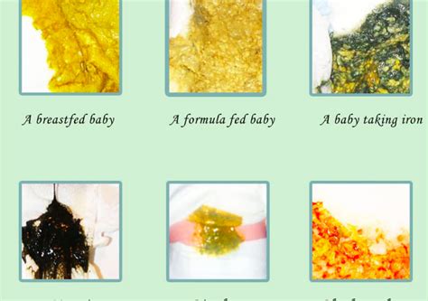 Contoh Najis Bayi yang Mengalami Cirit Birit: Kenali Perlu Diketahui