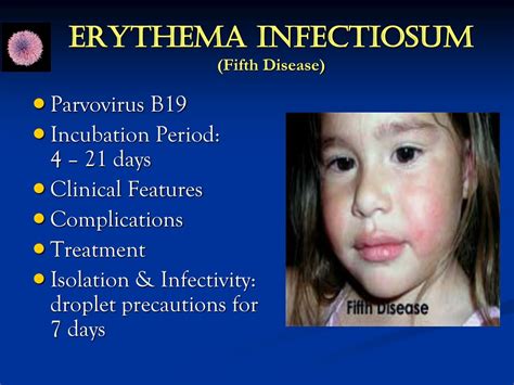 PPT - Childhood Infectious Diseases Overview PowerPoint Presentation, free download - ID:8813304