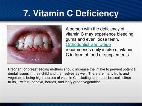 What Deficiency Causes Bleeding Gums