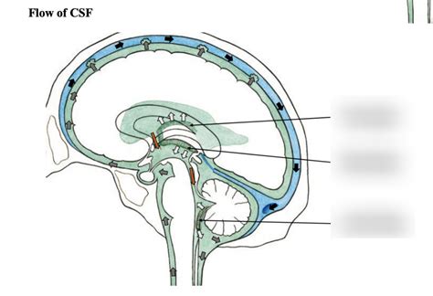 CSF Flow SCSN MRI 的图像结果