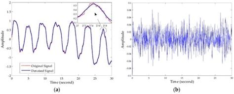 Short-Range Vital Signs Sensing Based on EEMD and CWT Using IR-UWB Radar