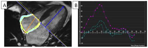 Cardiac Magnetic Resonance Imaging in the Evaluation of Functional ...