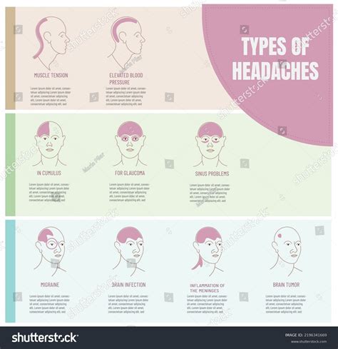 Infographic On Different Types Headaches According Stock Vector ...