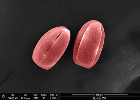 Image result for Flower Pollen Under Microscope