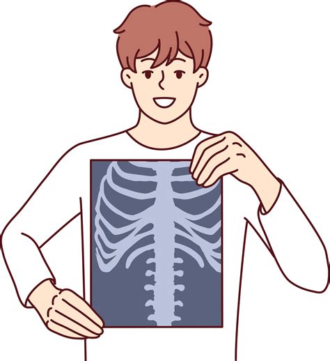 Chest X Ray Clipart