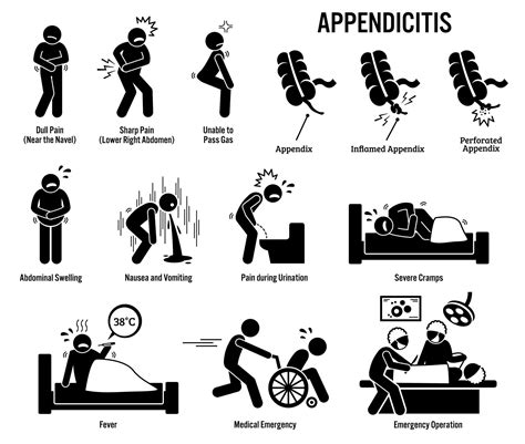 Image result for Appendicitis Assessment Signs