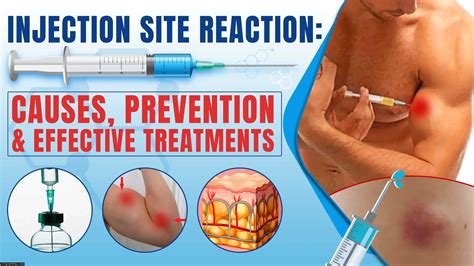 Image result for Injection Reactions