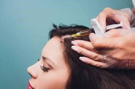Women's Hair Loss Causes, Treatments & Empowering Solutions at DNCC