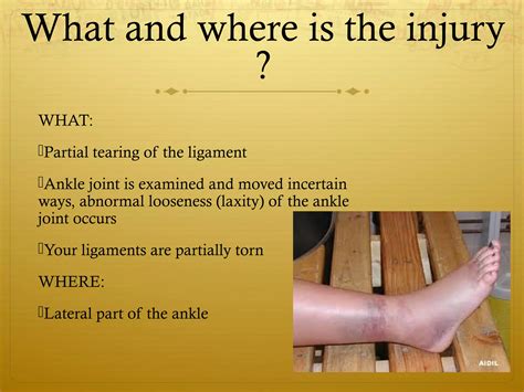 Sprained Ankle Grade II | PPT