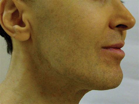 Health tips and precautions these 5 major symptoms on face indicates 5 ...