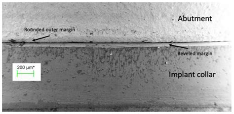 Effect of Electrodeposited Gold Coatings on Micro-Gaps, Surface Profile ...