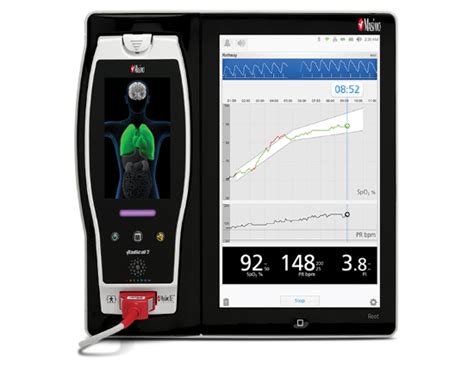 Image result for Masimo Root