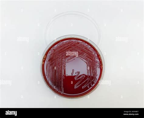 A Staphylococcus aureus bacteria displayed on a blood agar plate on ...