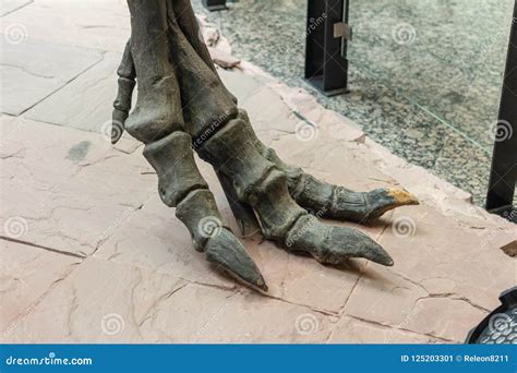 X -ray Foot Bone Fracture Base Of Metatarsal Fracture From Traumatic Injury And Step View Union ...