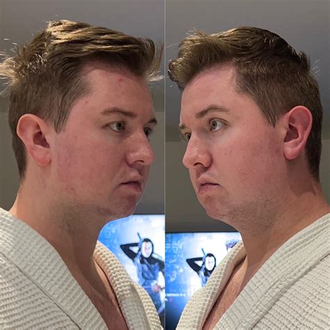 Why does one side of my face look so different to the other? What features are causing this, in ...