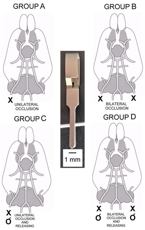 Temporary Occlusion of Common Carotid Arteries Does Not Evoke Total Inhibition in the Activity ...
