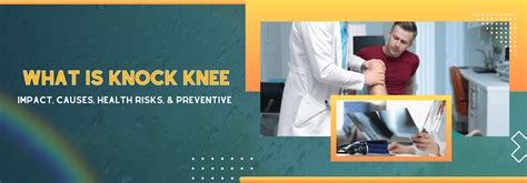 What Is Knock Knee: Causes, Symptoms, and Treatment Options - Abrol ...