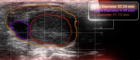 The Importance of Fertility Management in Dairy Cows - IMV Technologies ...
