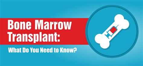 What To Expect After Bone Marrow Transplant – SDYEM