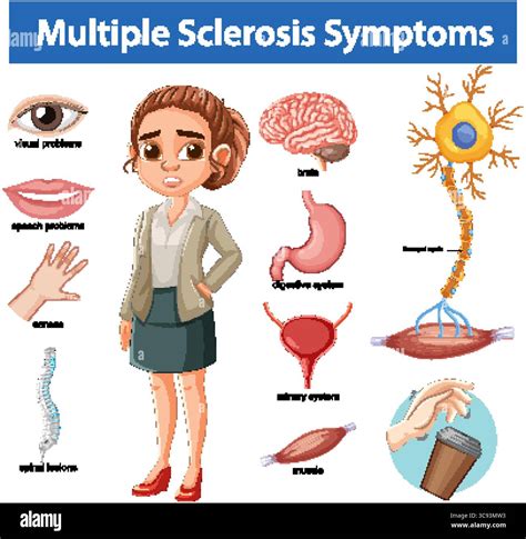 Vector illustration highlights multiple sclerosis symptoms with labeled organs, nervous system ...