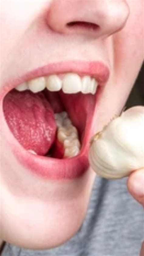 5 surprising health benefits of eating raw garlic