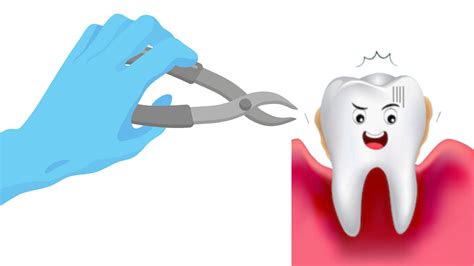 Does Gum Disease Go Away After Teeth Removal?