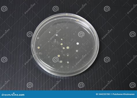 Colonies of Bacteria Growth on Agar Plate Stock Photo - Image of ...