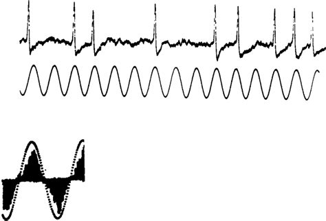 Image result for Phase Locking Auditory System