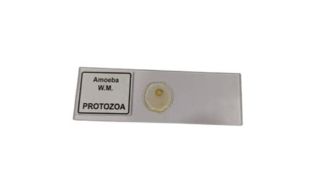 Amoeba Protozoa W.M Slides (Pk. of 5Pcs.) – scientifickart