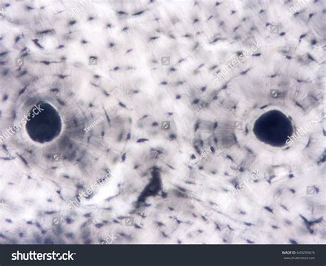 Compact Bone Connective Tissue