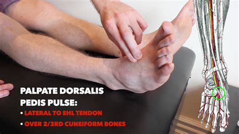 Pulse Assessment Dorsalis Pedis at Hector Myers blog