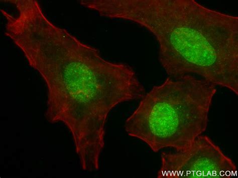 CCDC94 antibody (83580-5-PBS) | Proteintech