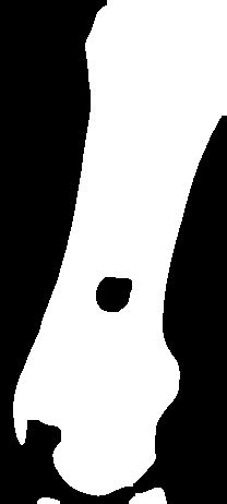 Thresholding Method Matlab Code 的图像结果