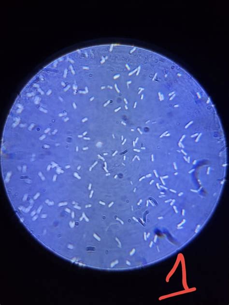 Escherichia Coli Morphology Recombinant Expression Of A Modified