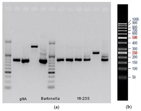 Evidence for Bartonella quintana in Lice Collected from the Clothes of ...