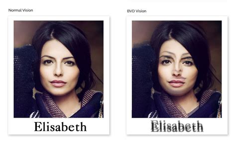 Image result for Binocular Vision Test