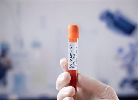 Blood sample in medical sample tube | Premium Photo