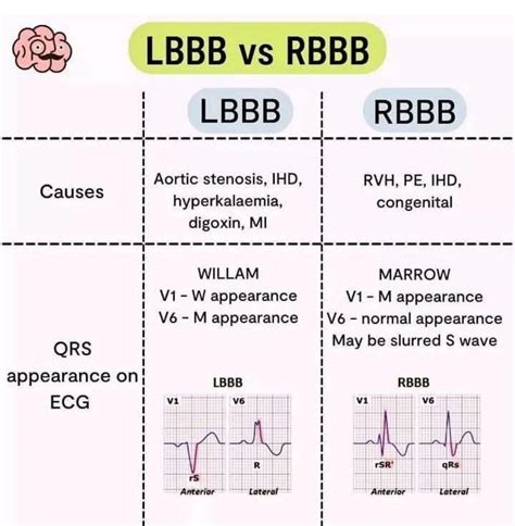 HouseOfMedicalKNLWandSkills | #ECG Acute Pericarditis Vs ST Elevation ...
