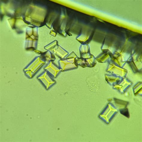 Triple Phosphate Crystals: Identification & Clinical Significance