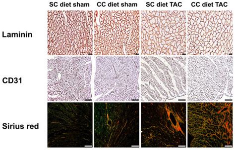 Coconut Oil Aggravates Pressure Overload-Induced Cardiomyopathy without ...