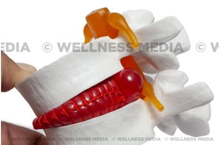 Disk Problem 的图像结果