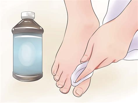 How To Manage Smelly Feet at Isaac Perdriau blog