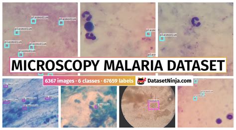 Microscopy Malaria Dataset - Dataset Ninja