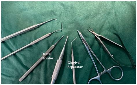 Tooth Extraction Equipment 的图像结果