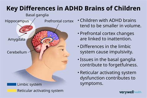 Image result for ADHD Brain Scan vs Normal
